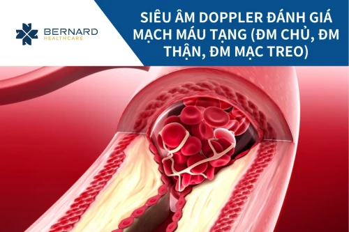 Siêu âm doppler đánh giá mạch máu tạng (ĐM chủ, Đm thận, ĐM mạc treo)